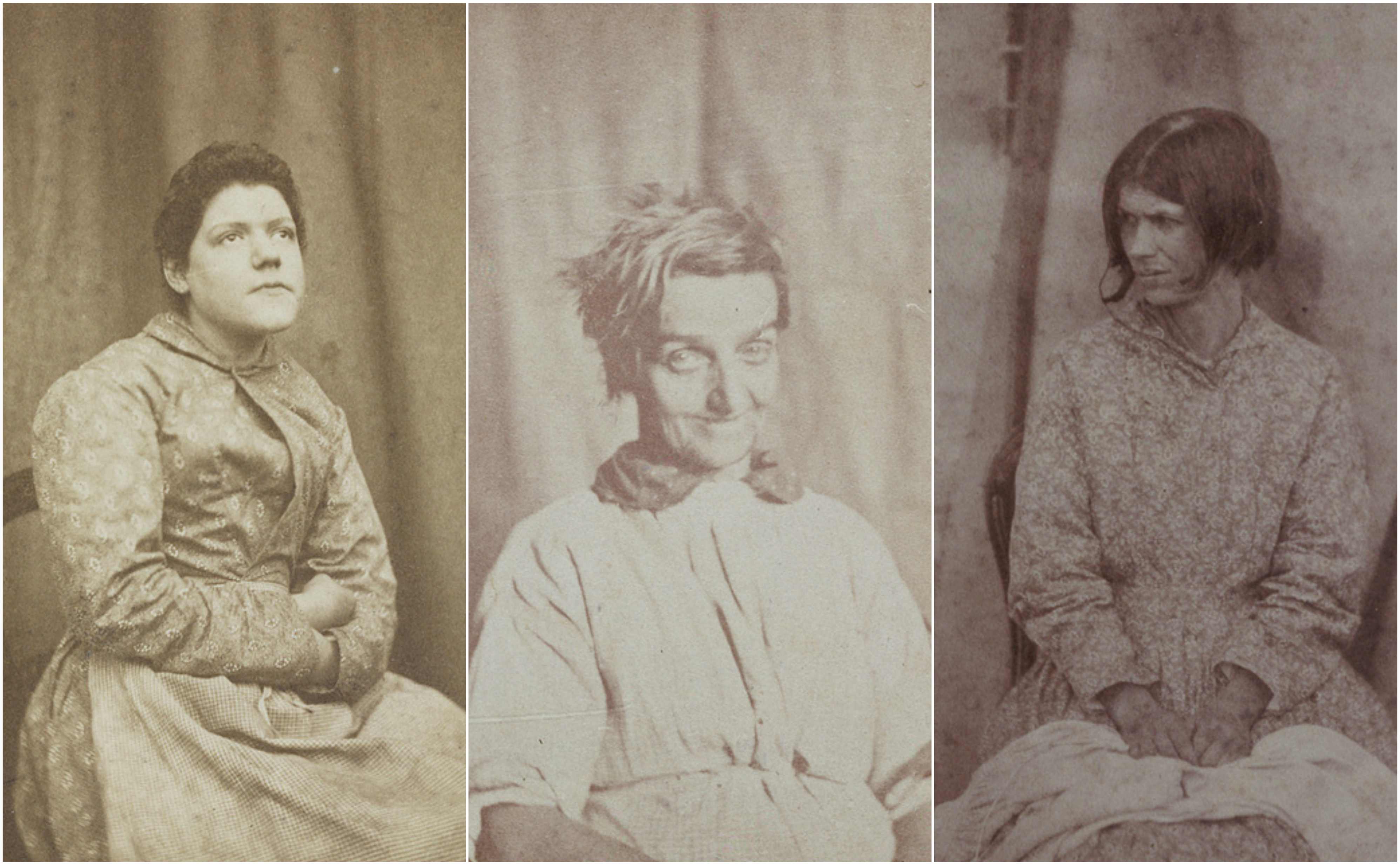 #picturethis: Photos of female asylum patients by a Victorian psychiatrist